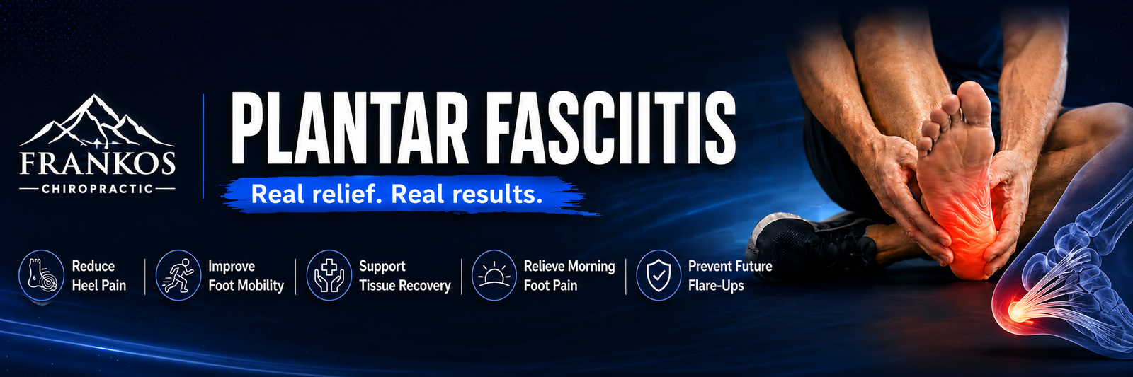 Plantar fasciitis treatment in Smithfield Utah at Frankos Chiropractic serving Cache Valley